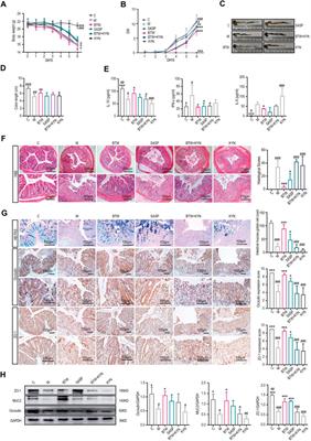 Baitouweng decoction alleviates ulcerative colitis by regulating tryptophan metabolism through DOPA decarboxylase promotion